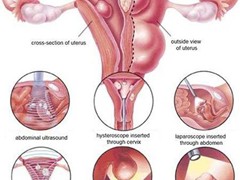 endocrinologist in Bharuch                        