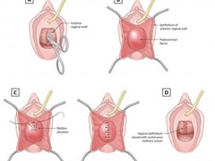 gynecologist hospital in Bharuch                        