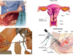 Surgical Hospital in Bharuch                        